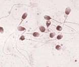 Foto de espermatozoides em microscópio eletrônico