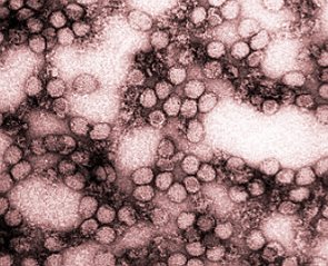 Imagem de microscópio do vírus da febre amarela